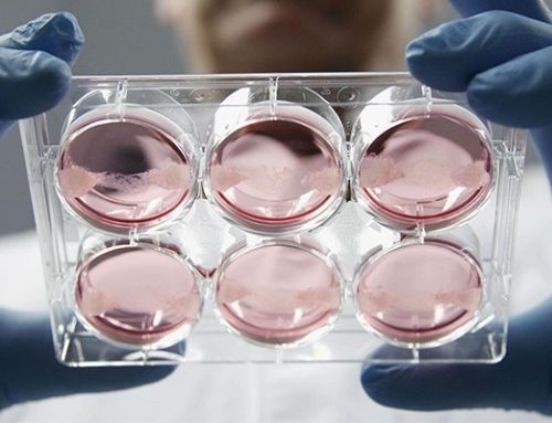 Reducing Microbiological Growth in Your Lab